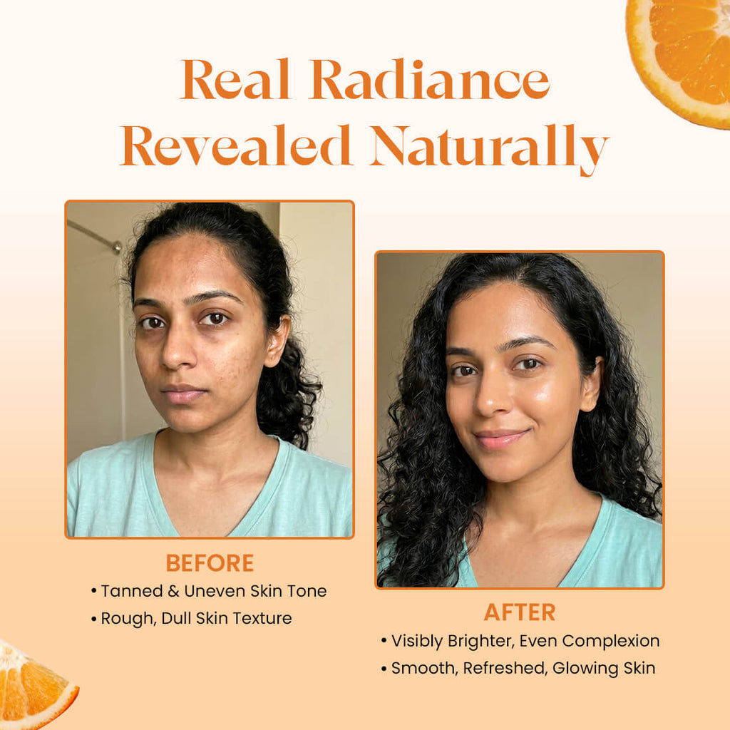 Orange Peel Powder | For Skin Brightening & Tan Removal | 200g