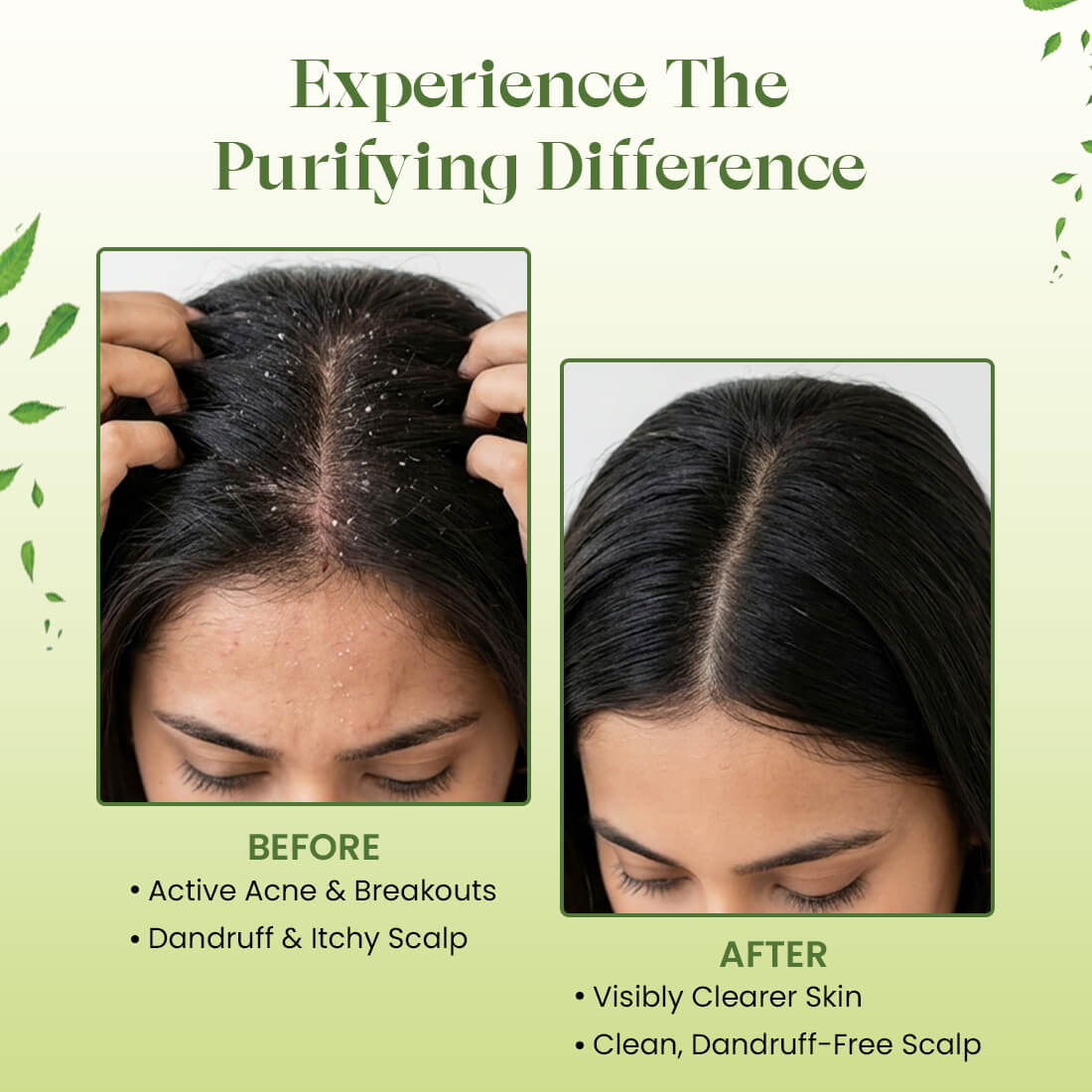 Neem Powder | Skin Purifying  & Hair Care Powder | 200g