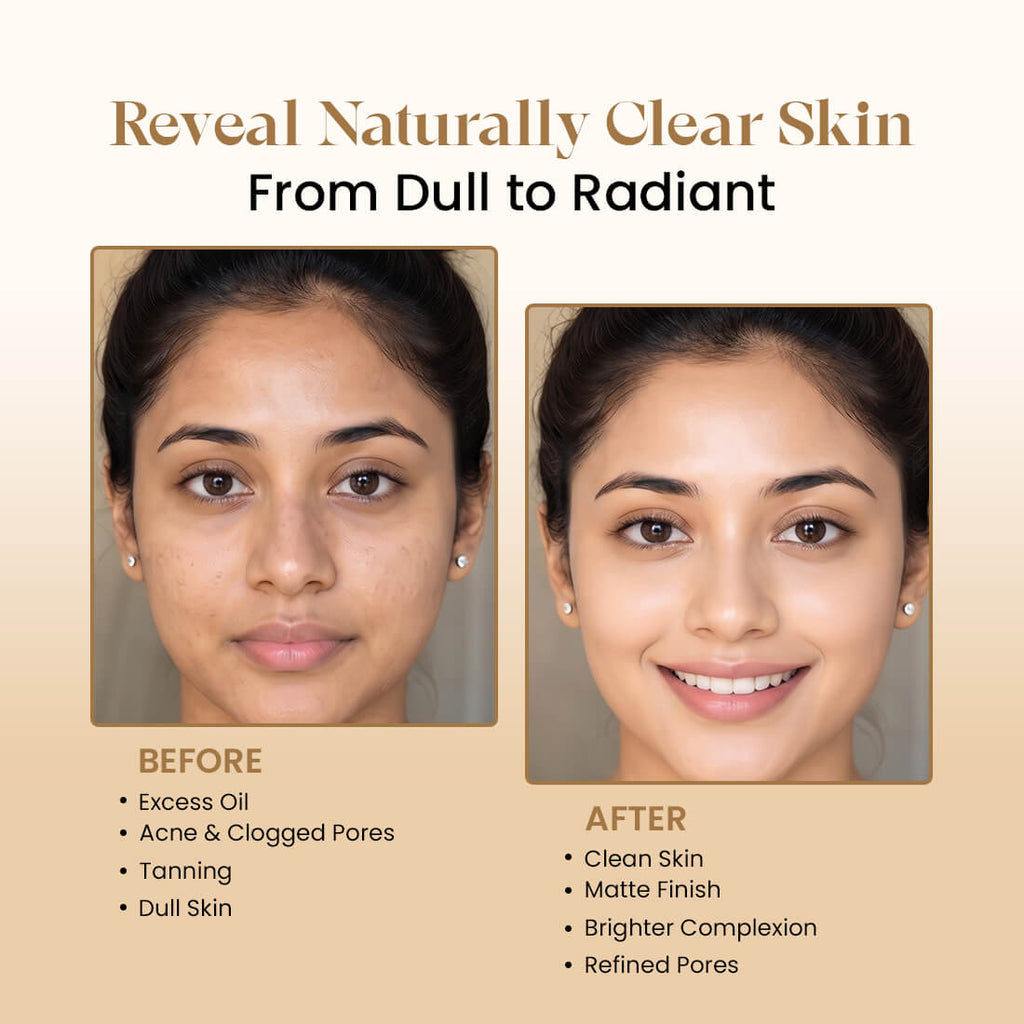 Multani Mitti Powder | For Deep Cleansing & Glow  | 200g