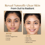 Multani Mitti Powder | For Deep Cleansing & Glow  | 200g