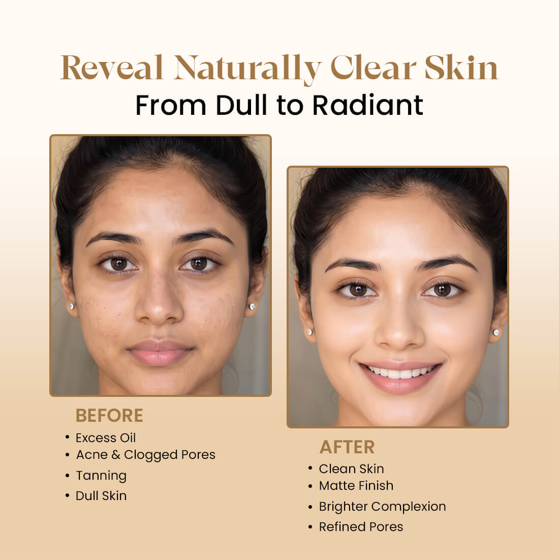 Multani Mitti Powder | For Deep Cleansing & Glow  | 200g